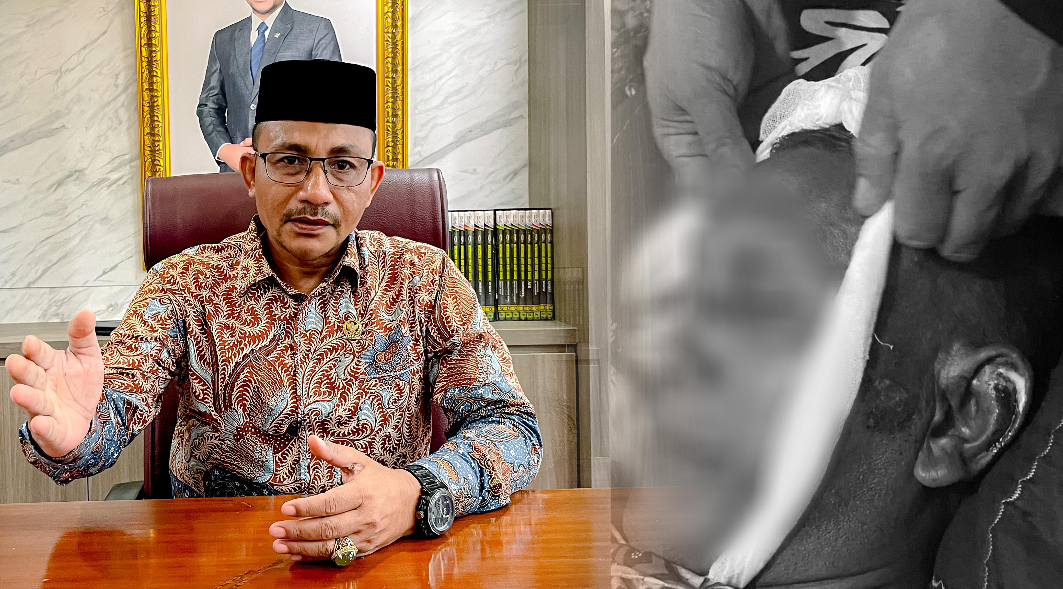 Warga Aceh Utara Meninggal Dunia diduga akibat Dianiaya Oknum Polisi, Haji Uma Minta Polda Aceh Tangani Serius