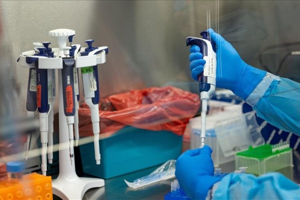 Pemerintah Siapkan 12 Lab untuk Periksa Virus Mpox