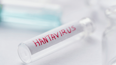 Suspek Hantavirus di DIY Negatif