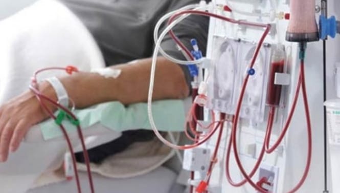Dinkes DKI Soroti Pasien Cuci Darah Mayoritas Anak Muda